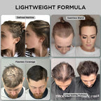 Hair Building Fibers Set for Thinning Hair & Bald Spots
