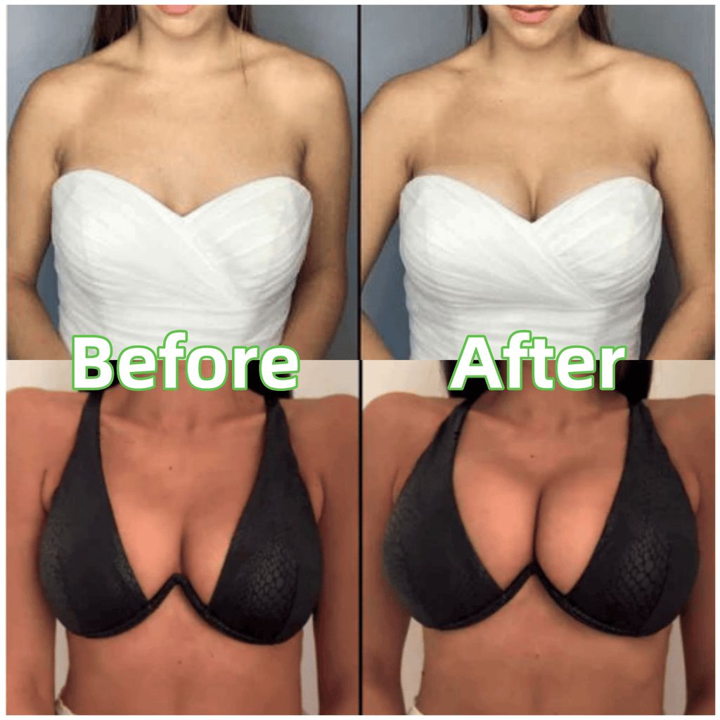 💕OUFALI Lift Inserts for Bras – Lightly Padded. Double-Sided Adhesive👙 Reusable. Washable • Natural Lift • Seamless Under Clothing ✨