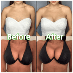 💕OUFALI Lift Inserts for Bras – Lightly Padded. Double-Sided Adhesive👙 Reusable. Washable • Natural Lift • Seamless Under Clothing ✨