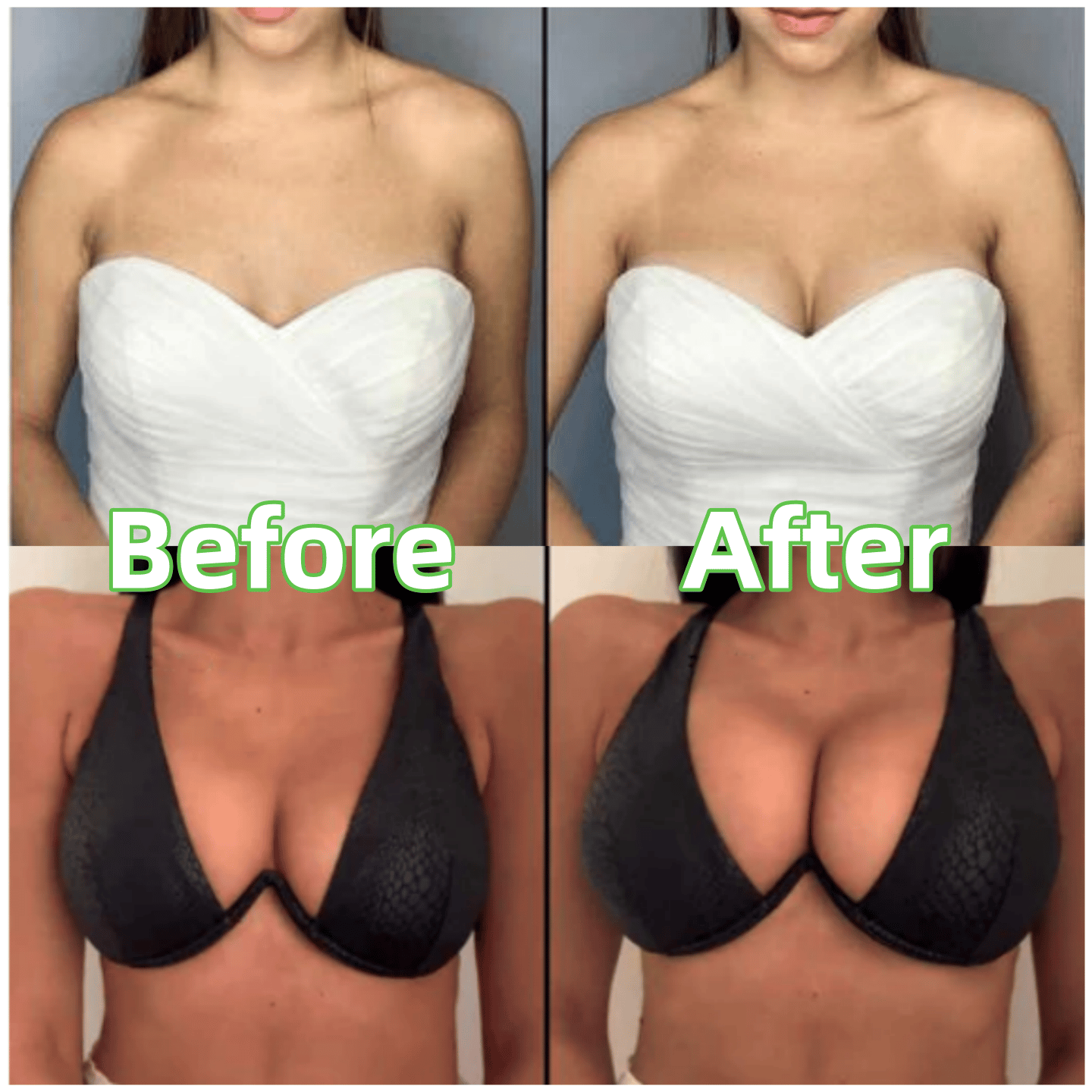 💕OUFALI Lift Inserts for Bras – Lightly Padded. Double-Sided Adhesive👙 Reusable. Washable • Natural Lift • Seamless Under Clothing ✨